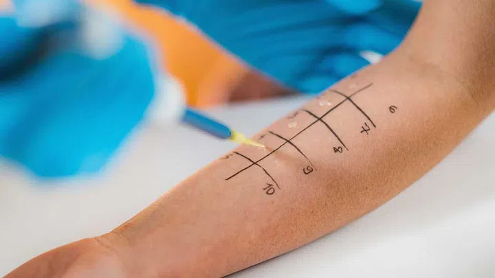 Seeing a qualified allergist, is your best bet for identifying exactly what you're allergic to and ensuring safe and effective treatment.