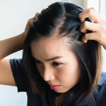 PHS Hairscience postpartum hair loss main