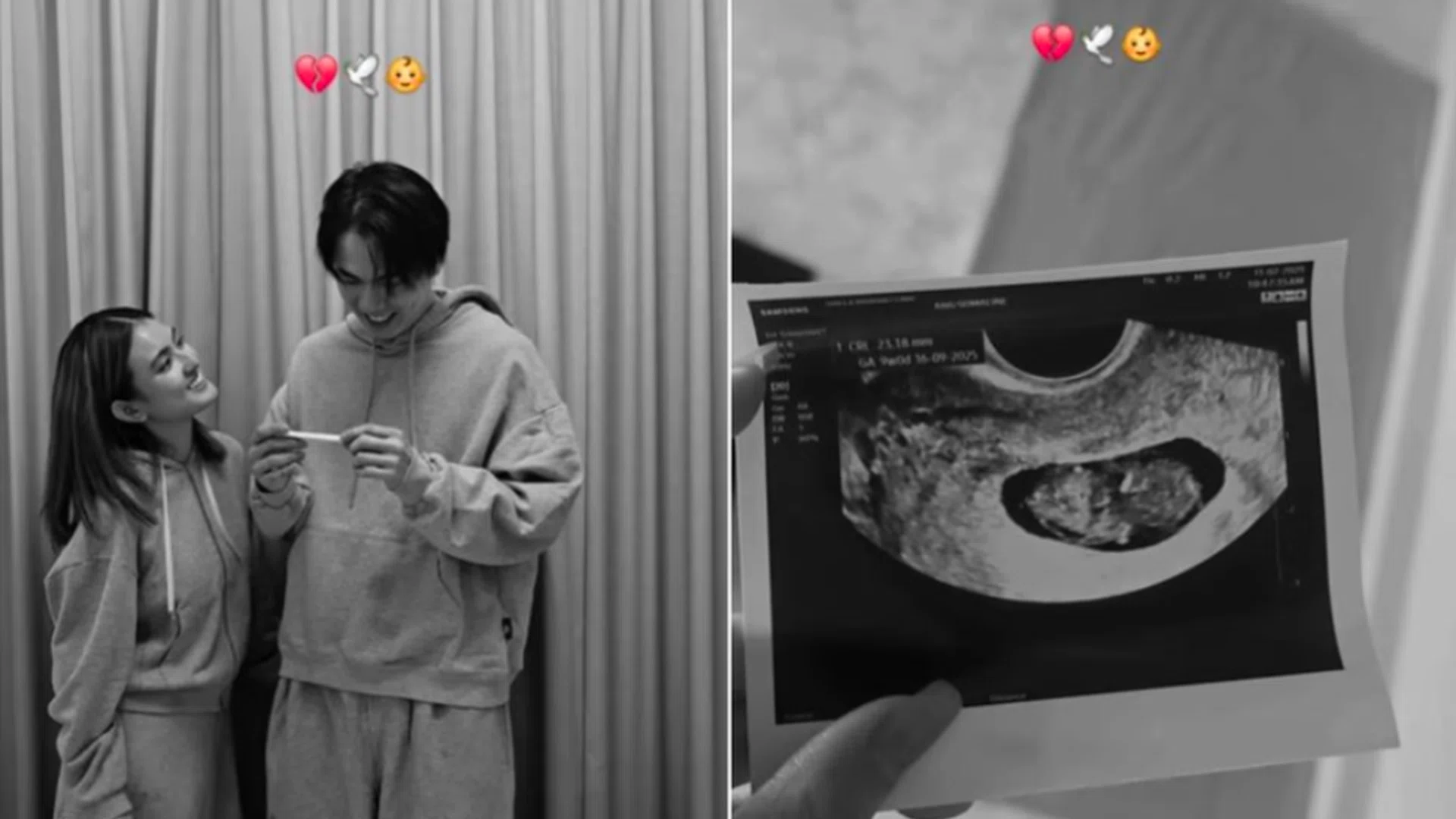 Local celebrity couple Hong Ling and Nick Teo revealed on Mother's Day that they recently suffered a miscarriage. Photo: HONGLINGG_/INSTAGRAM