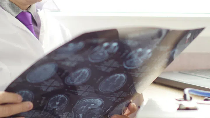 Medical doctor analyzing brain MRI scan