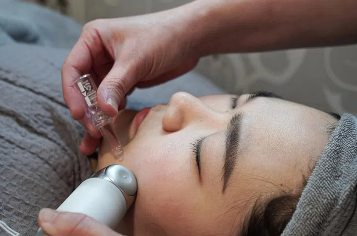 skin-exosomes-therapy-microneedling-facial-bmf