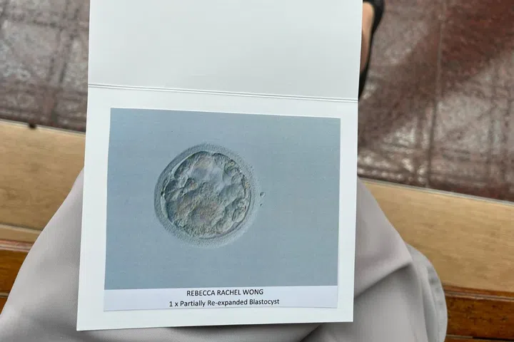 unexplained fertility at 29 - rebecca rachel wong