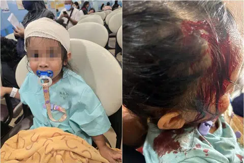 铁钩从天而降 两岁女童头破血流