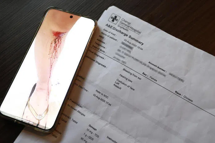 妇女指自己与丈夫争执期间双膝受伤。（纪允贤摄）