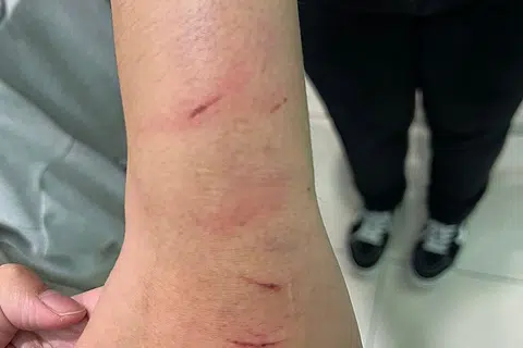 不满被质问是否劈腿 男子狂鞭女友致遍体伤