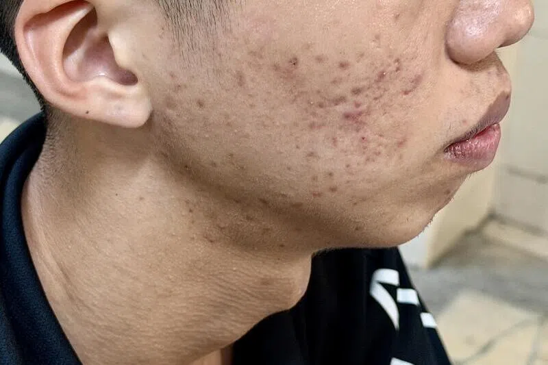 妇申诉 儿被诱导花2520元 免费测脸变买配套