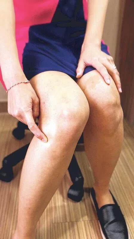 足三里穴（档案照）