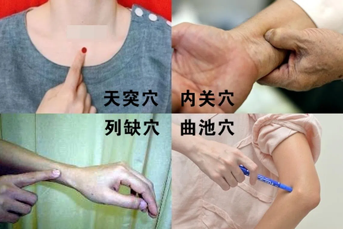 天突穴、内关穴、列缺穴与曲池穴。（档案照）