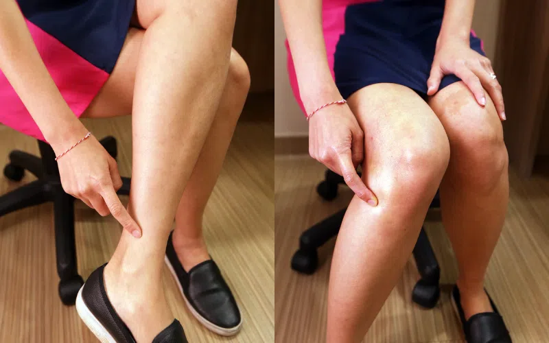 左图为三阴交穴，在小腿内踝上三寸， 胫骨内侧缘的后方。右图为足三里穴，位于外膝眼下四横指， 胫骨前一横指的交叉点上。（档案照片）