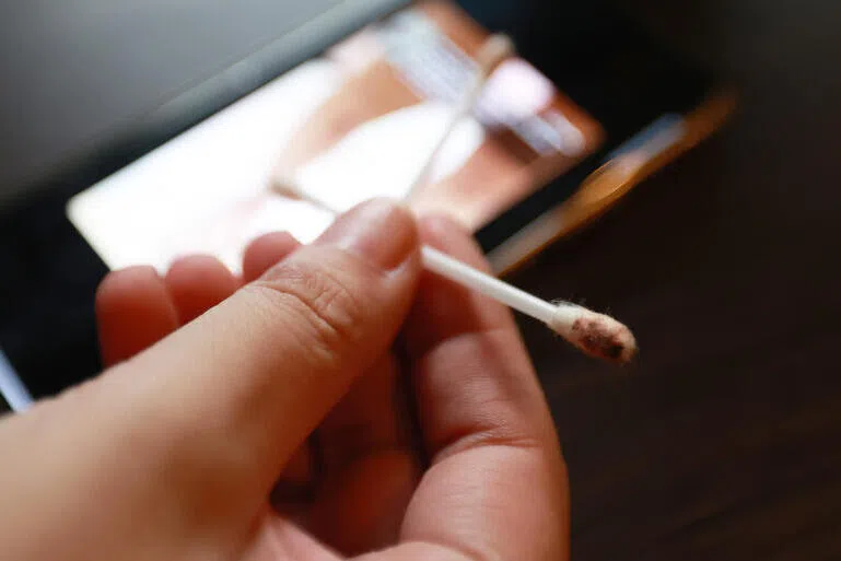 陈太太上个月耳朵流血后使用过的棉签。（纪允贤摄）