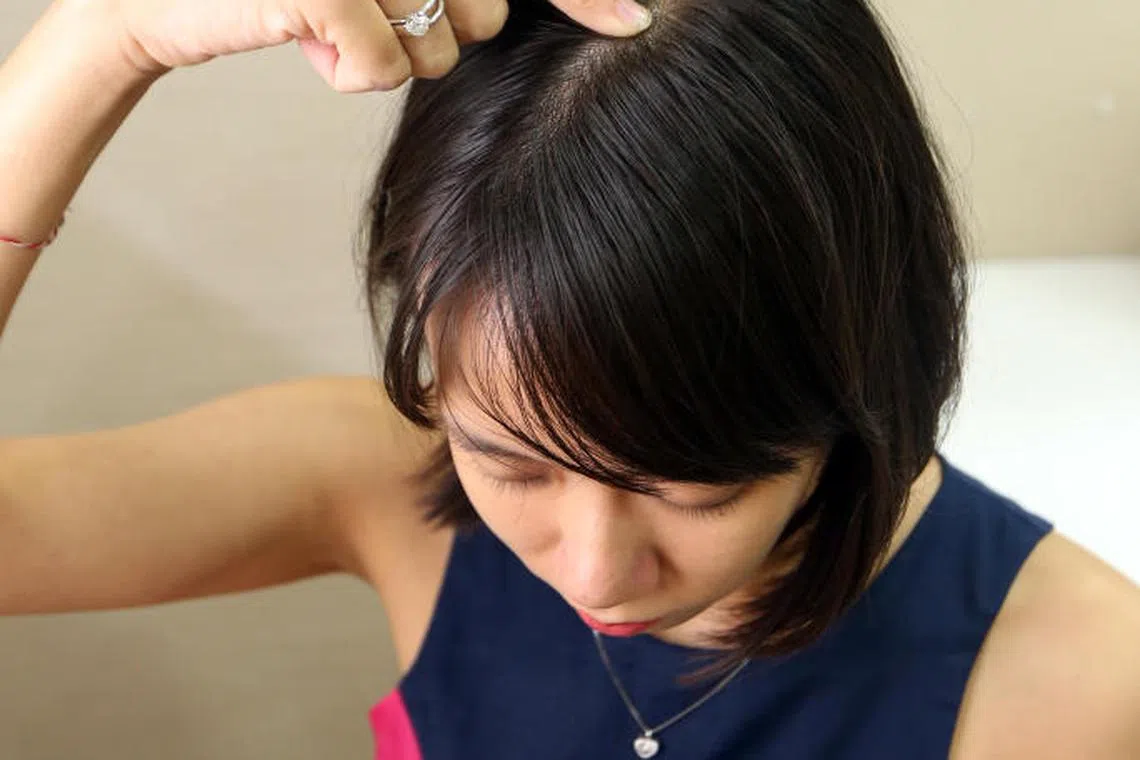 百会穴：位于头顶正中线与两耳尖（折叠耳朵可确定耳尖）连线的交叉处。（档案照）