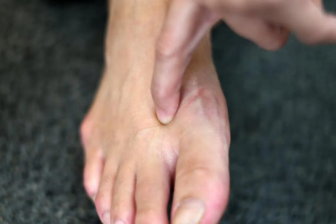 太冲穴。（档案照）