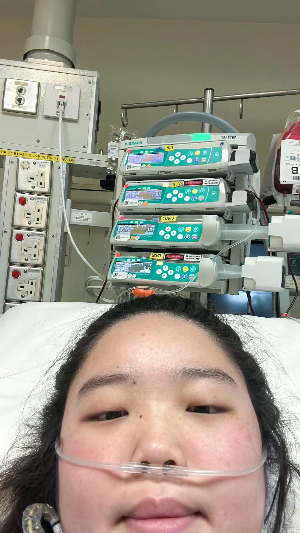 赖佳敏持续高烧入院，病情恶化并出现心脏衰竭，但因不适合使用镇静药物，医疗团队为她实施清醒ECMO治疗。（受访者提供）