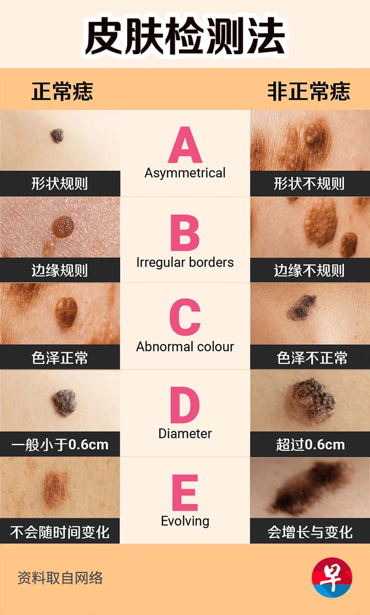 皮肤检测ABCDE检测法。（图/林玲莉）