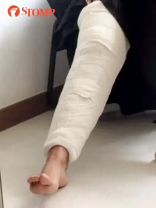 女子到医院求医，受伤的右脚被包扎，医生也给予14天病假。（取自STOMP）