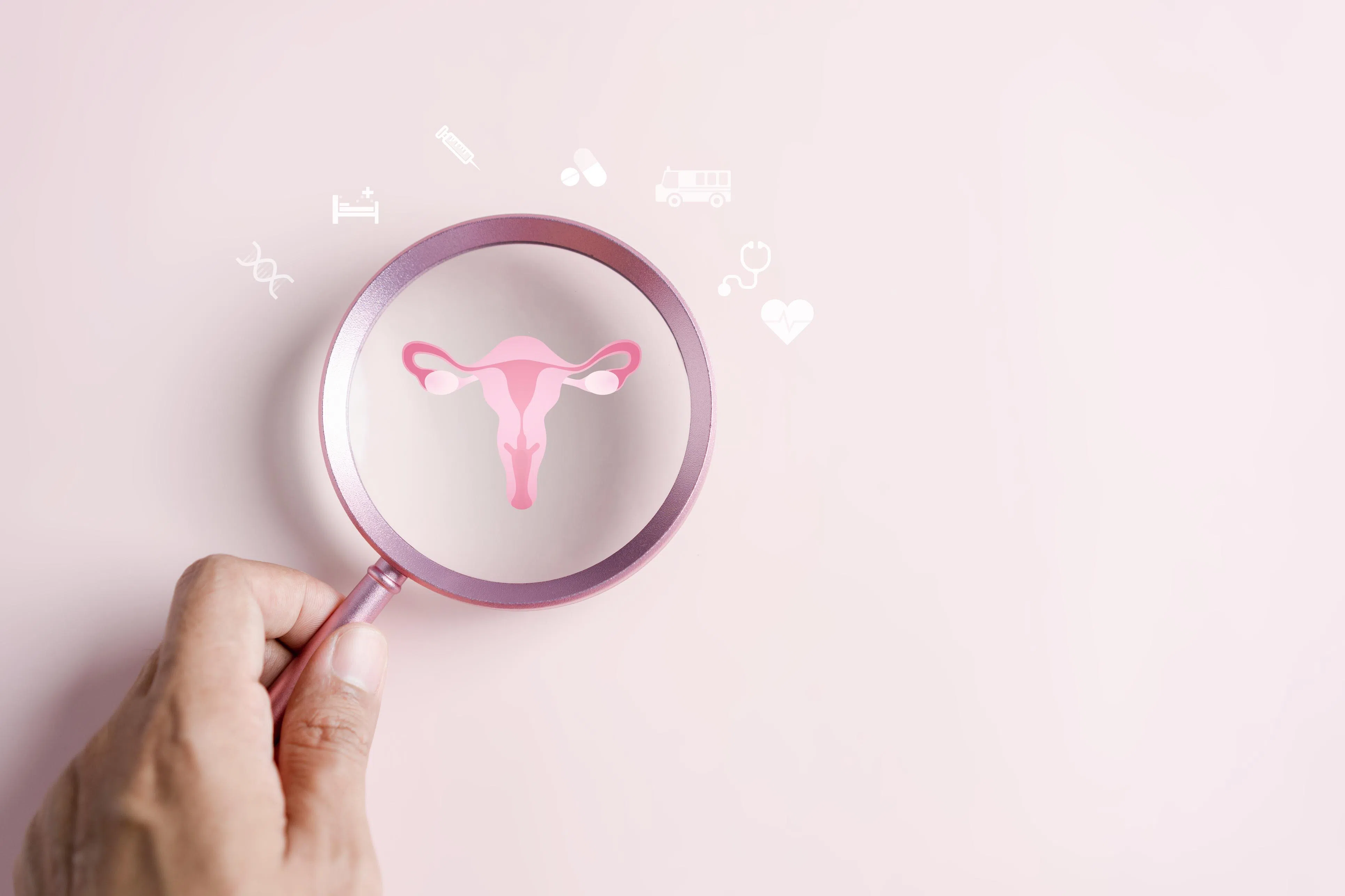 子宫颈抹片检查有助于及早探测到子宫颈癌前期病变。（iStock图片）