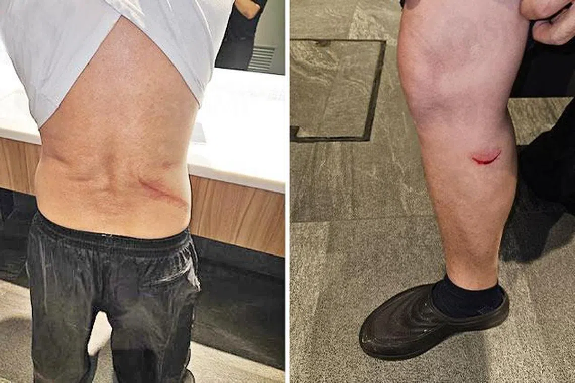 私召车司机身上有多处伤口和刮痕。（图/STOMP）