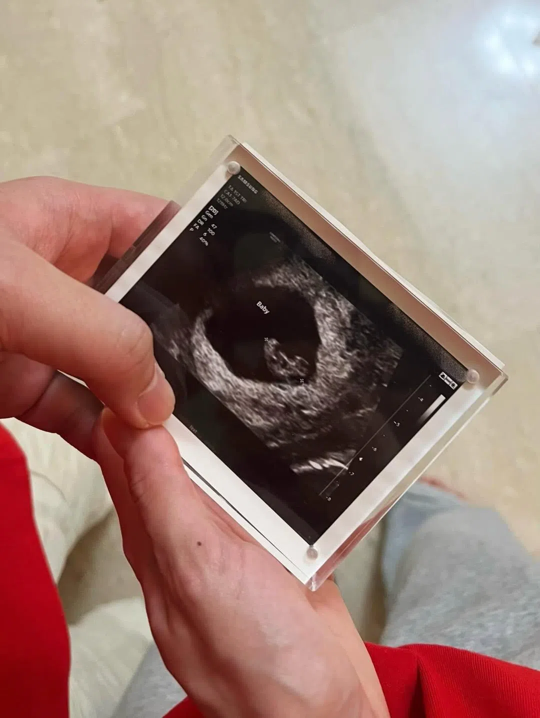 林汐目前怀孕四个月。（取自林汐IG）