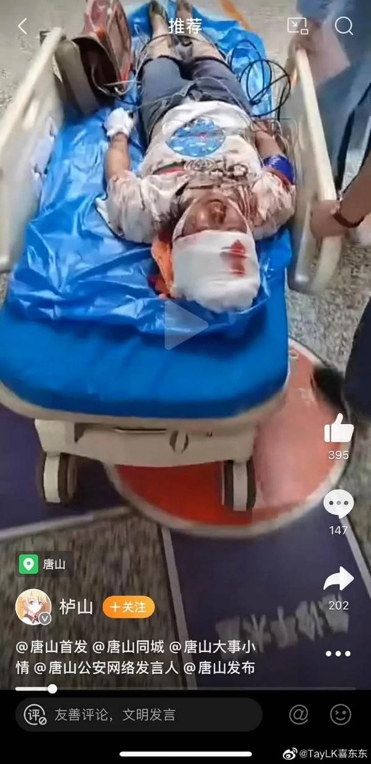 唐山打人事件中的女受害者，被打得头破血流。（互联网）