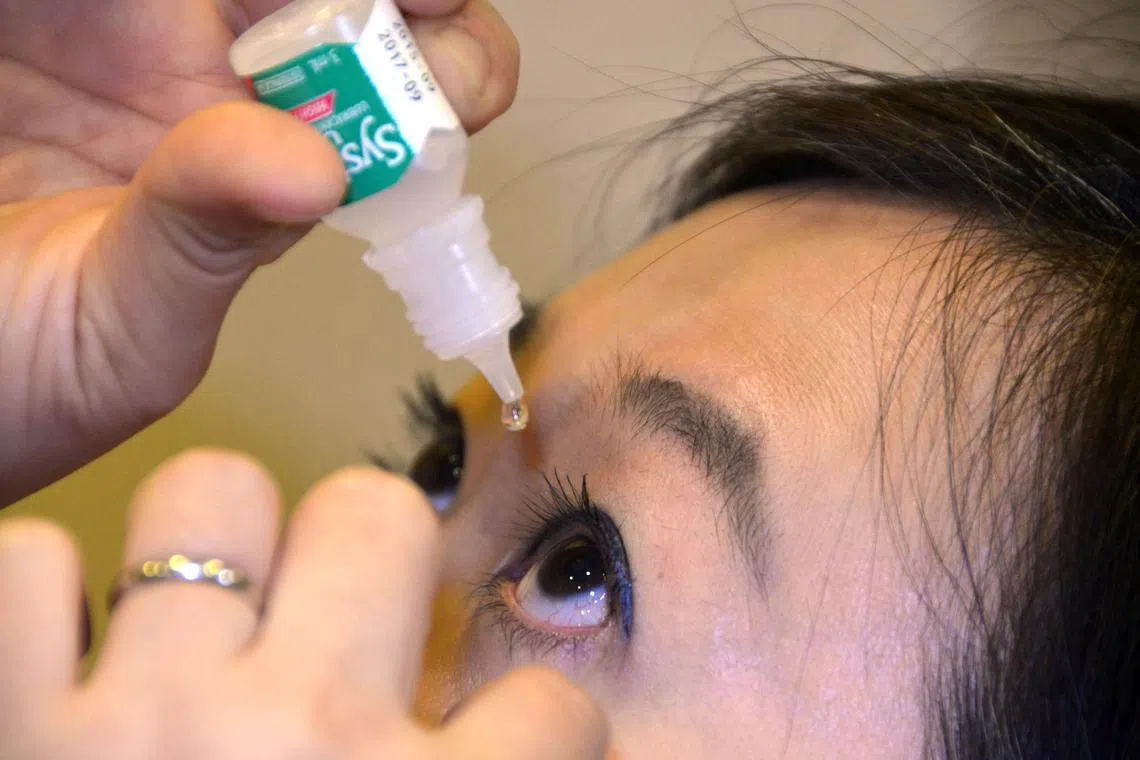 女性是干燥综合征发病率较高群体。（档案照）