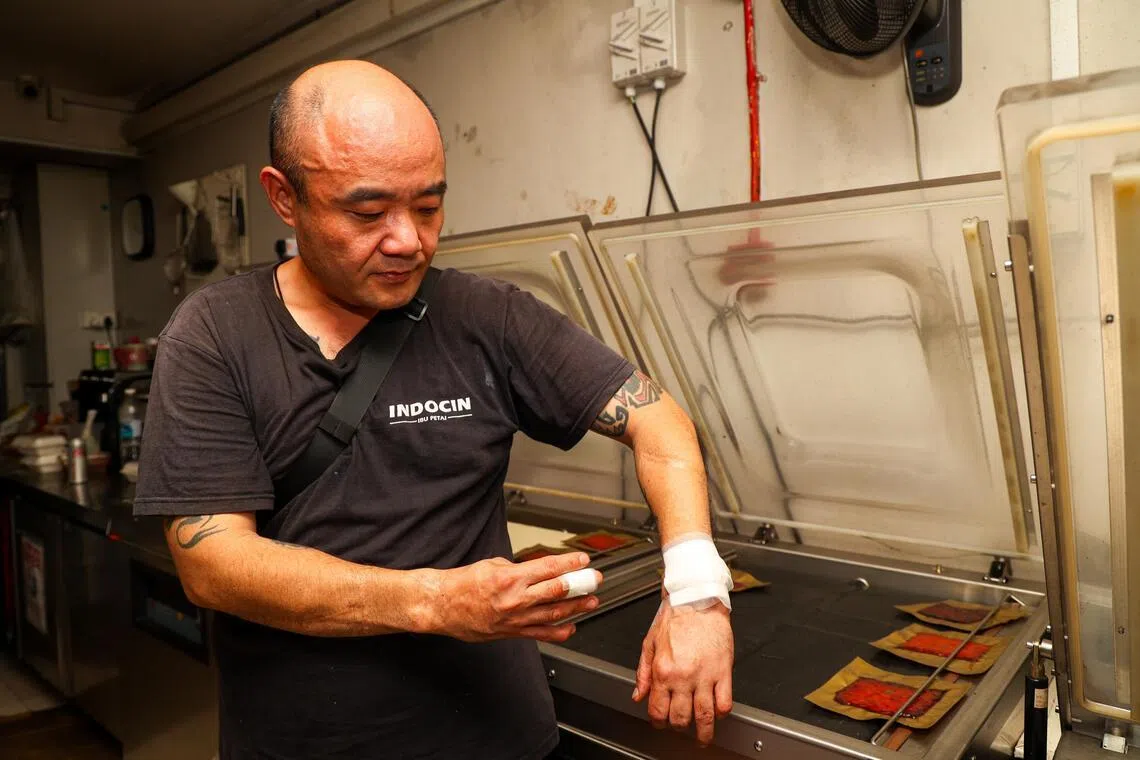 肉干店员工康德成因尝试拉开肉干铁网而双手烫伤。民防人员事后为他进行包扎。（林明顺摄）