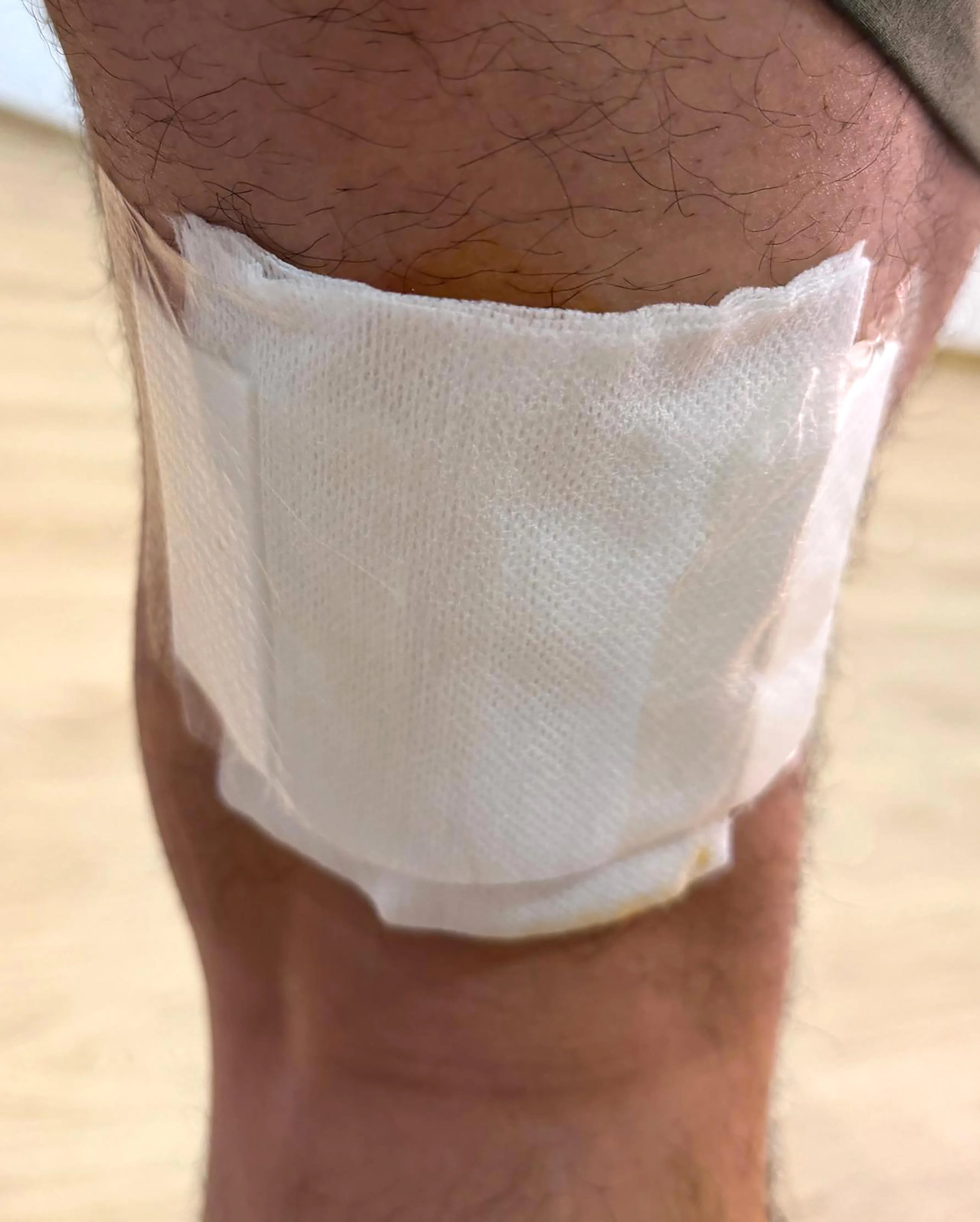 高姓顾客说，他们亲自跑到医馆讨说法，涉事医师才替丈夫包扎伤口。（受访者提供）