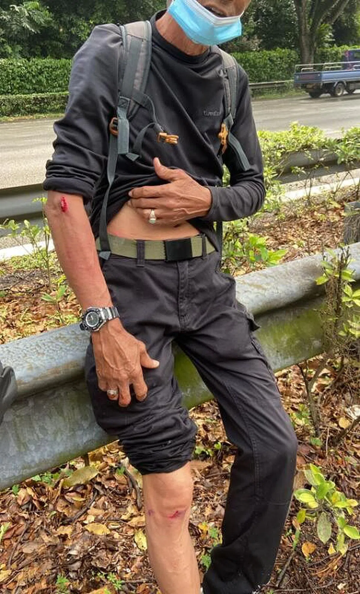 电单车骑士全身几处擦伤，但拒绝送院治疗。（受访者提供）