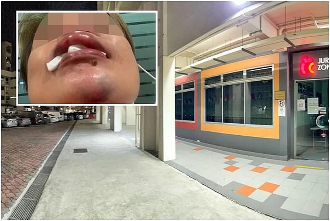 劝阻青年聚赌居委女经理被打伤| 联合早报