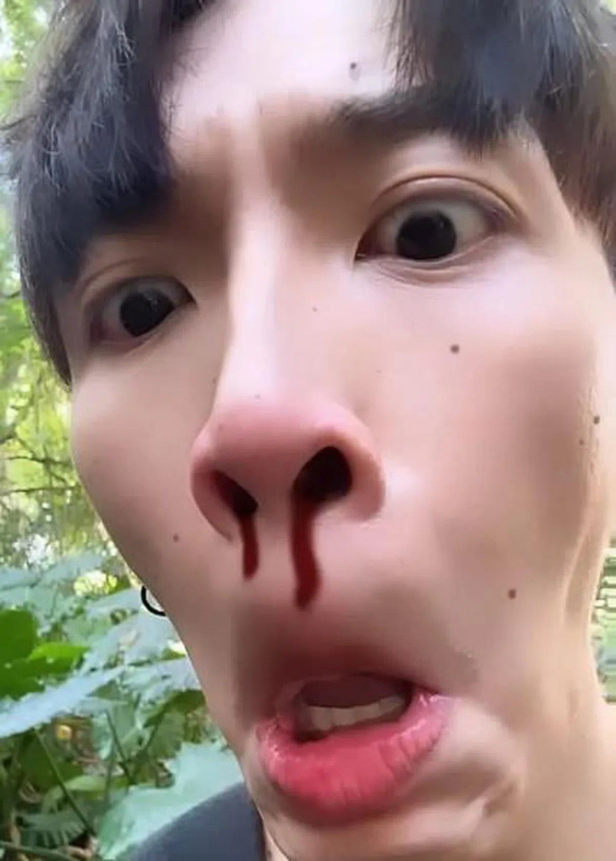 柯震东懒理暧昧裙裙传闻，晒出“流鼻血”画面。（取自艺人Instagram）