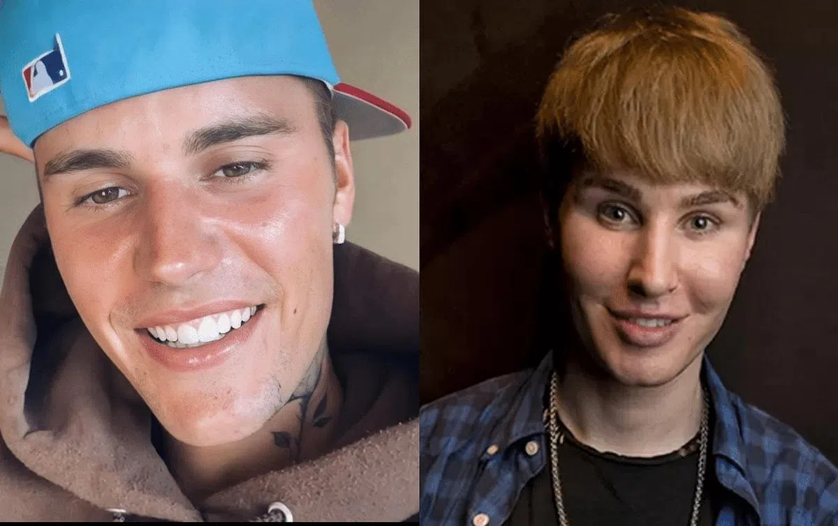 已于2015年离世的德国创作歌手Tobias Strebel（右）花近十万美元把自己整成Justin Bieber（左）模样。（Justin Bieber IG、互联网）