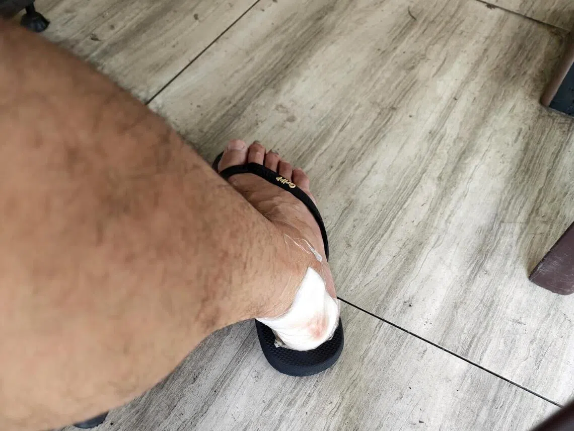 曹先生之后被送院检查，医护人员也为他包扎伤口。（受访者提供）