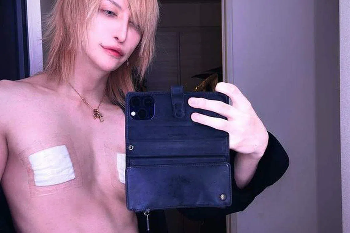 ＭiA切除了乳头。（取自艺人推特）