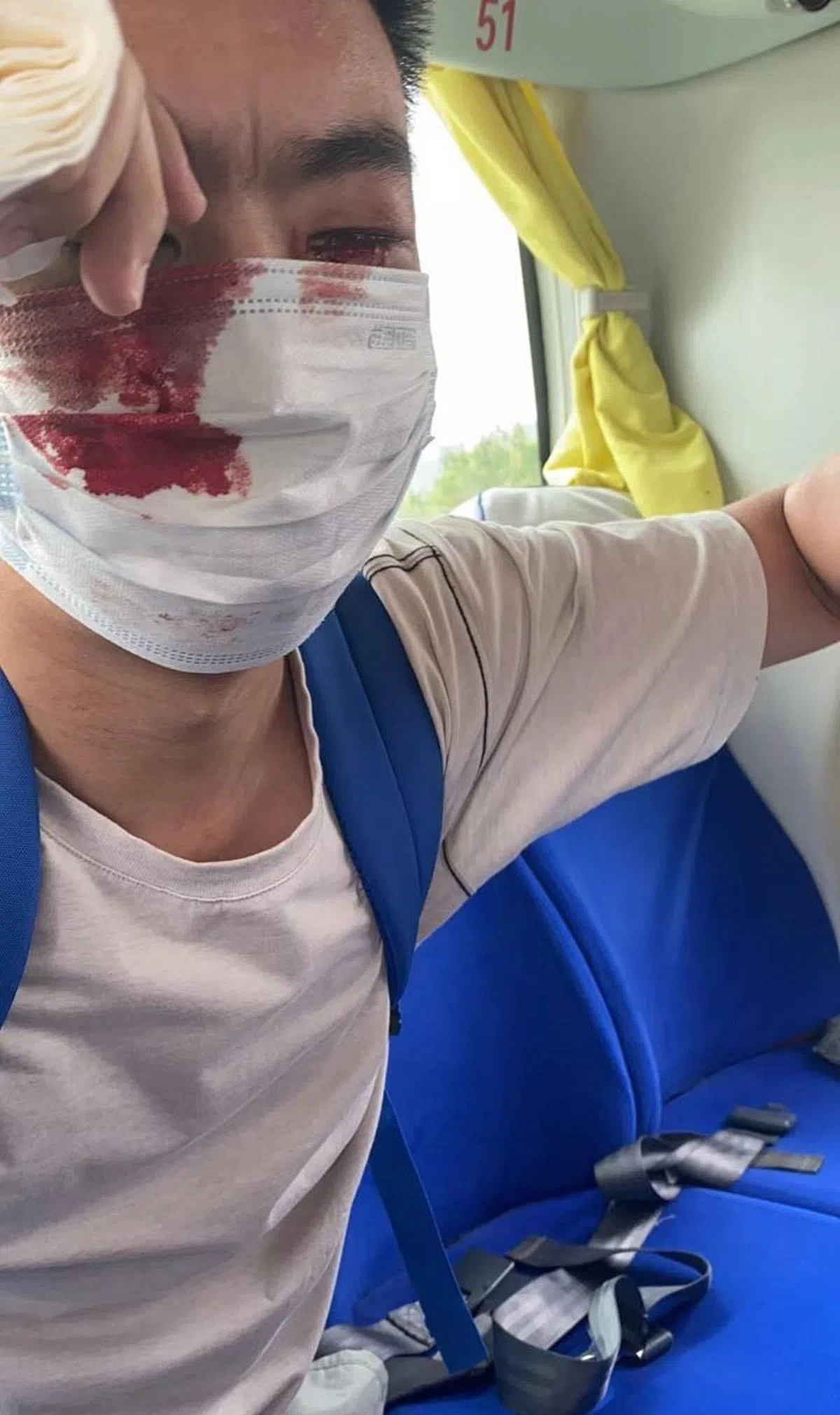 网传照片显示，一名据称是维权人士的男子受伤。（“二月兰糯糯”微博账号）