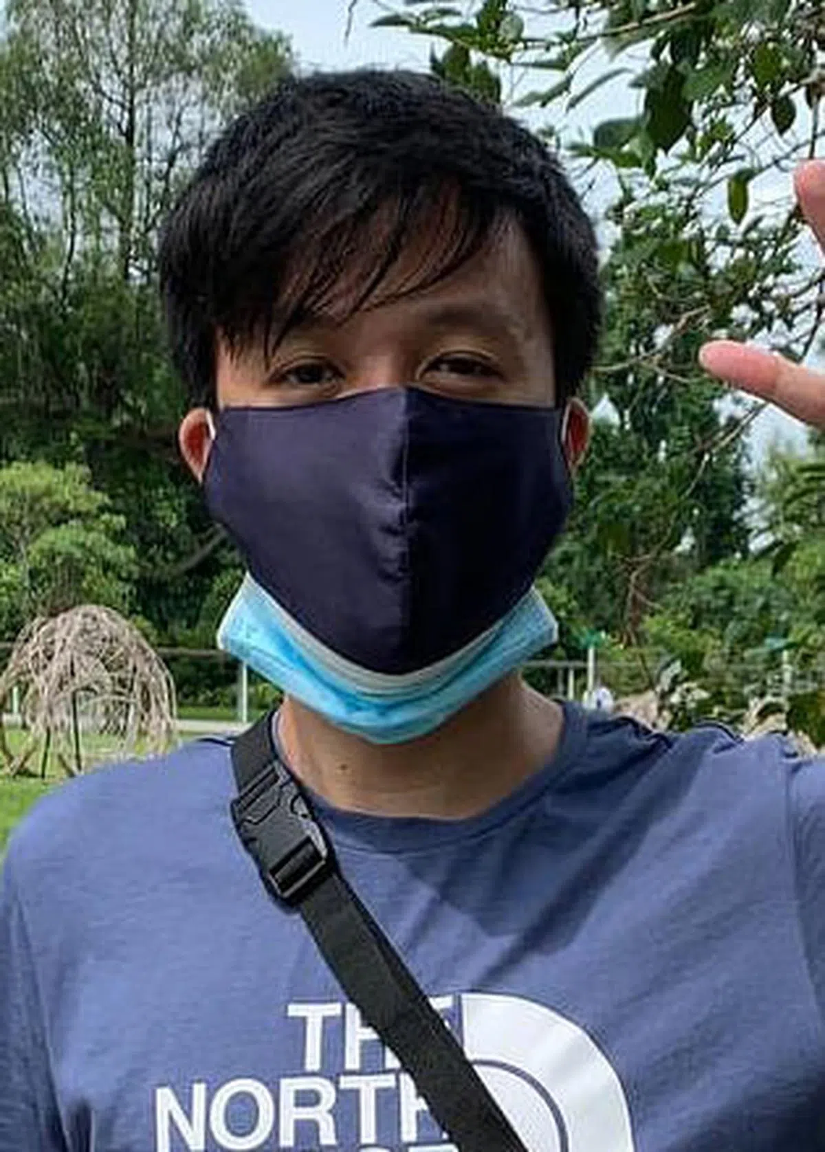 陈扬霖把尿路造口袋和结肠造口袋视为自己得以正常生活的途径，而不是缺陷。（受访者提供图片）