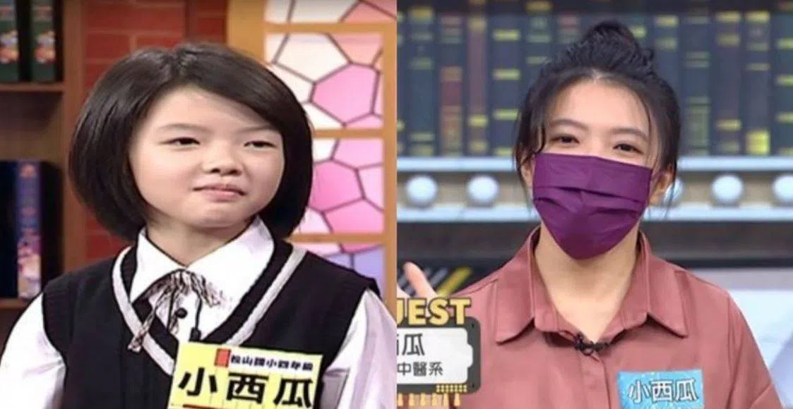 小西瓜曾在疫情期间戴口罩上节目，因此没有露出全貌。（互联网）