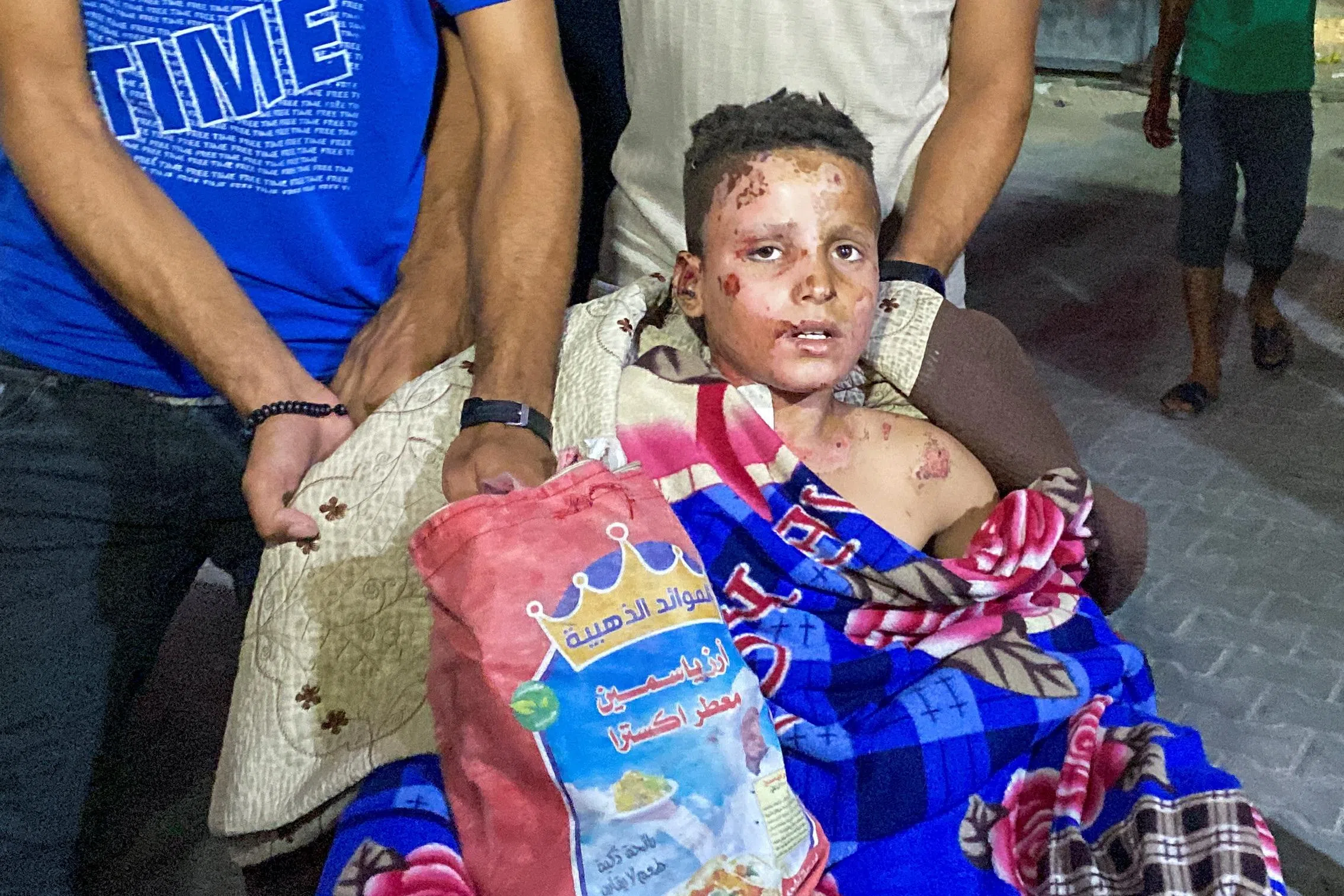 以色列袭击贾巴利亚难民营后，一个受伤的小孩在医院接受救治。（路透社）