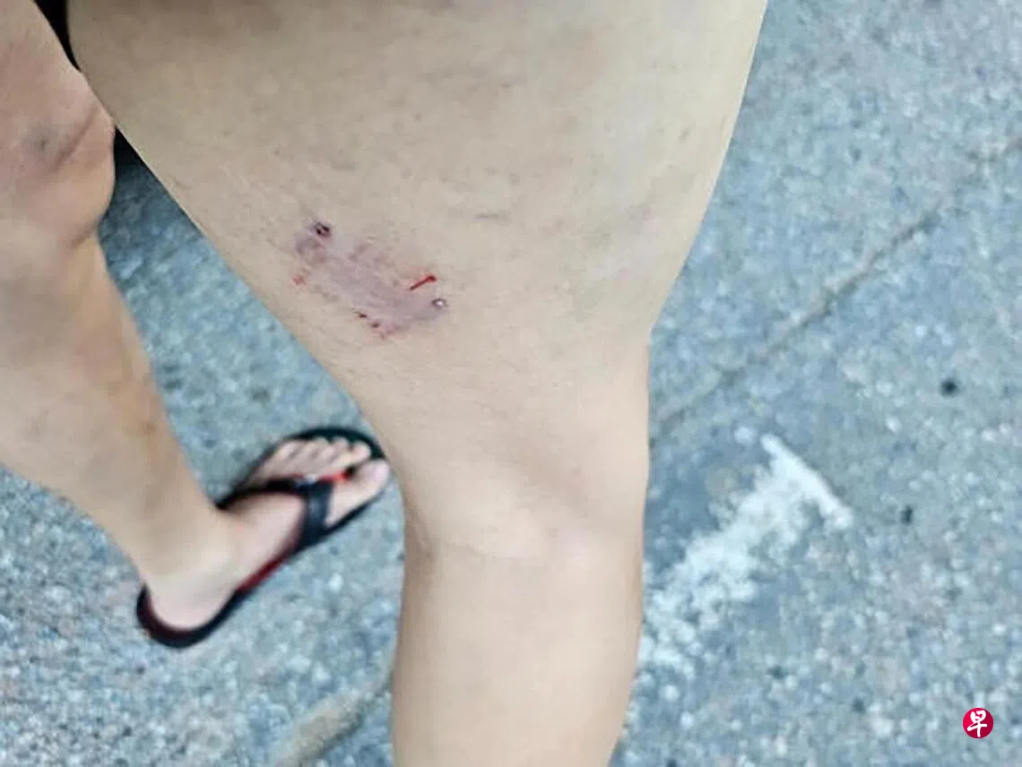 捕捉伤人野狗方式惹议当局：用捕捉杆符合标准| 联合早报