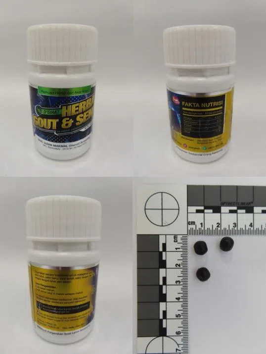 妇女服用“D’SIHAT HERBA GOUT & SENDI”以治疗膝关节疼痛，七个月后，她体重增加，下肢浮肿，血糖升高，被送入院。（档案照片）