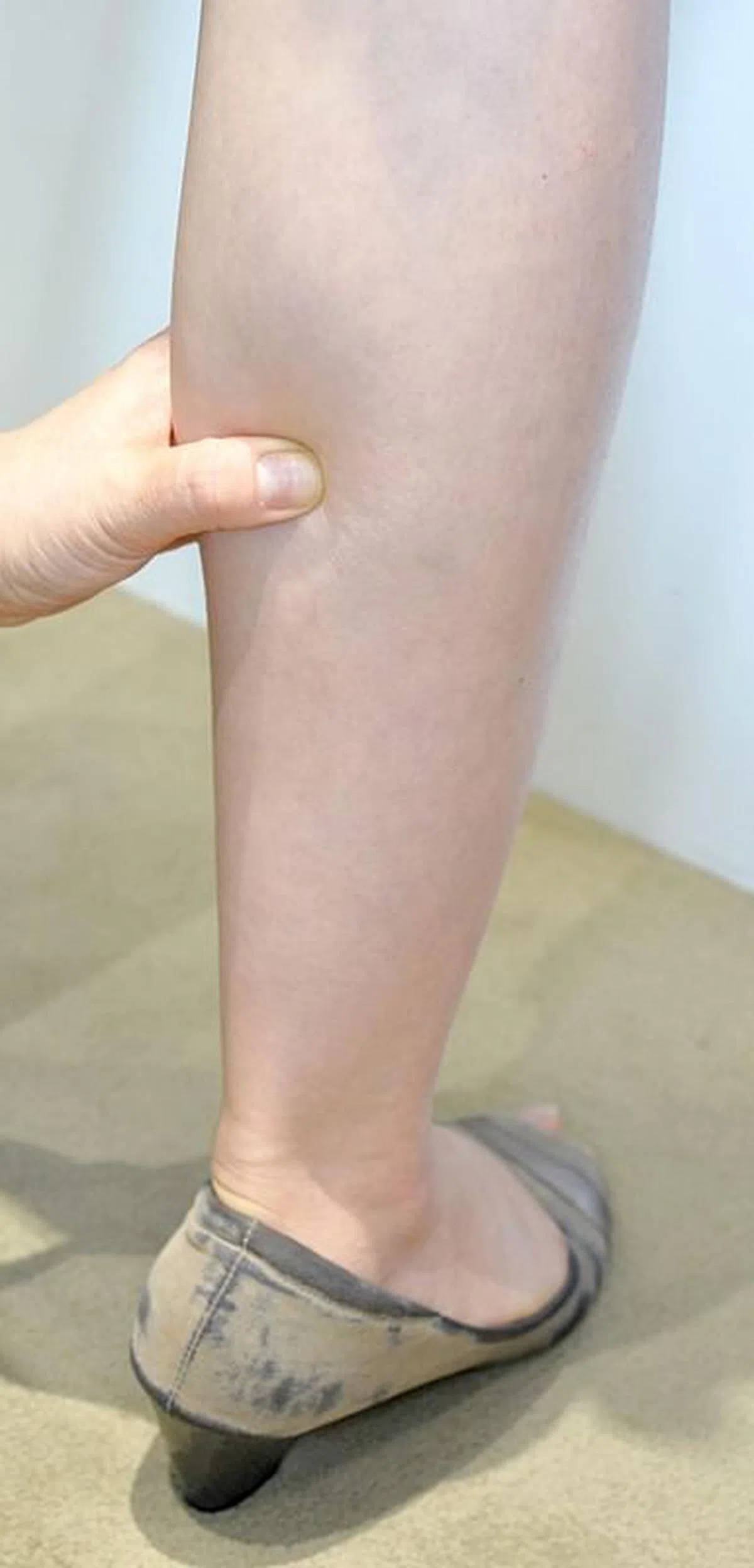 承山。（档案照）