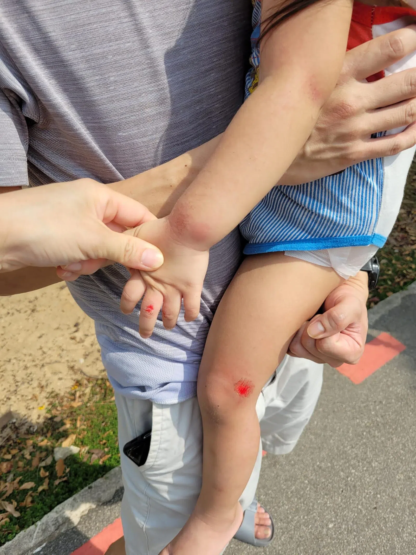 一对母女在东海岸公园散步，结果一辆脚踏车突然从后方飞驰而来，撞上母女两人。女儿当时被撞飞，脸部、手脚都磨破皮流血，自己则头和背部则撞到地上。（档案照片）