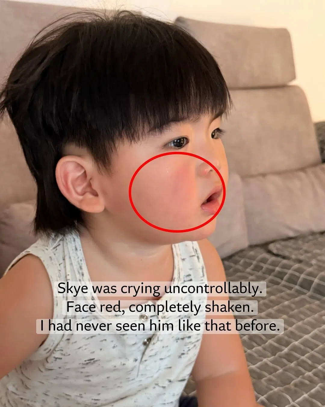 Skye的脸颊在摔倒后泛红。（取自马艺瑄IG）