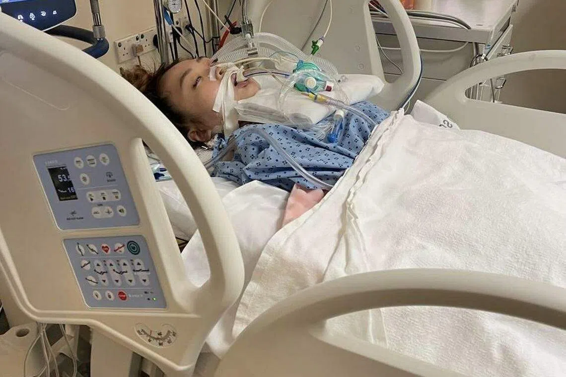 江紫盈进行抢救时昏迷近十天，也得靠两种不同的机械仪器维持生命。（受访者提供）