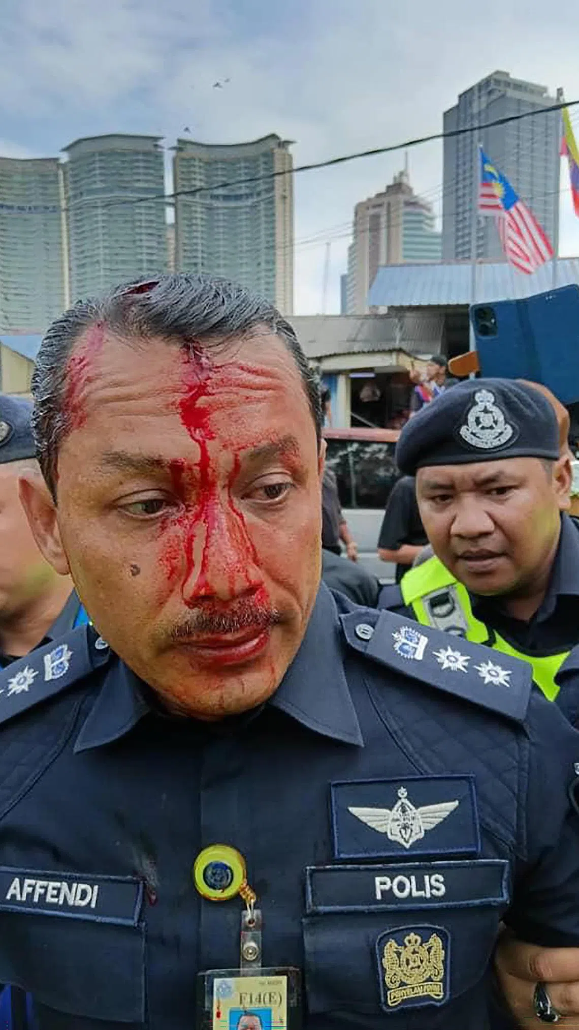 吉隆坡金马警区主任苏里斯阿芬迪星期四（9月11日）在甘榜双溪峇鲁拆迁行动引发的警民冲突中受伤。（取自安华脸书）