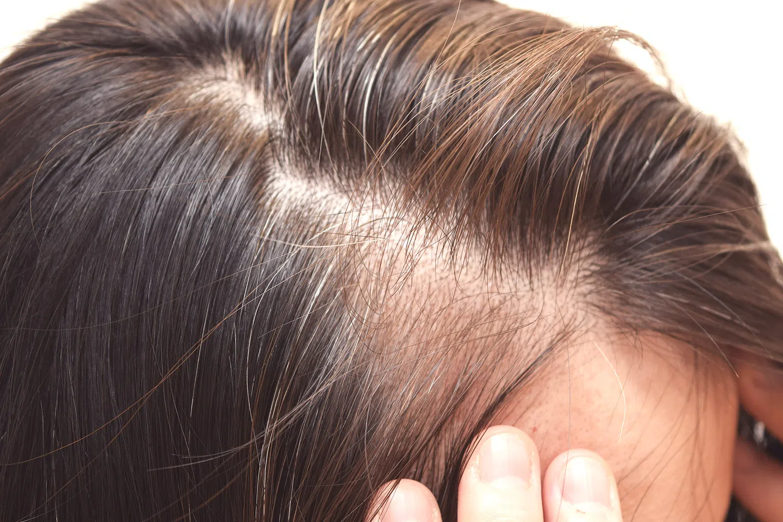 拥有一头健康的秀发让人显得更年轻。（图/DR D医美医疗诊所提供）