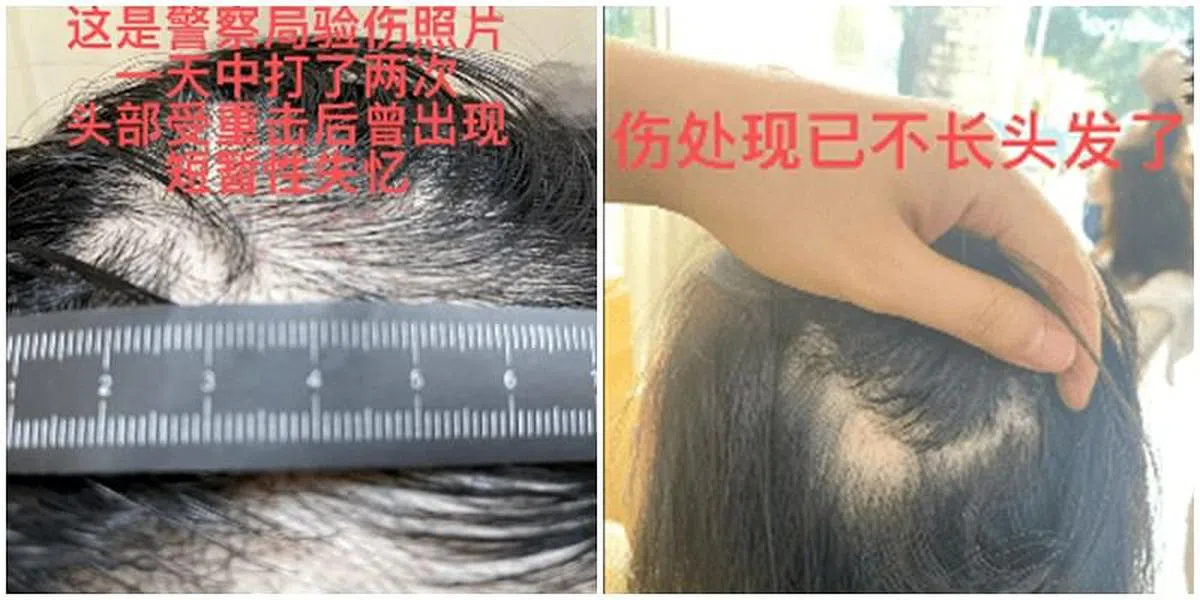 王东妻子晒出被家暴证据。（取自微博）