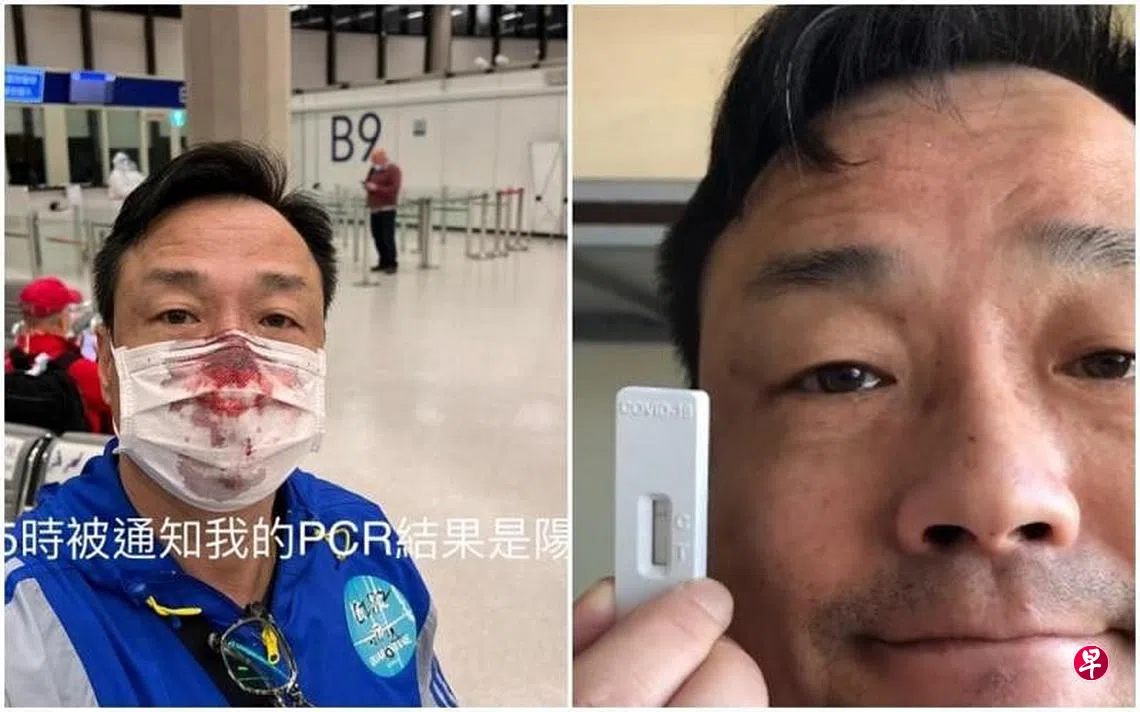 王喜不满在台检测流鼻血“通缉”医护人员给说法| 联合早报