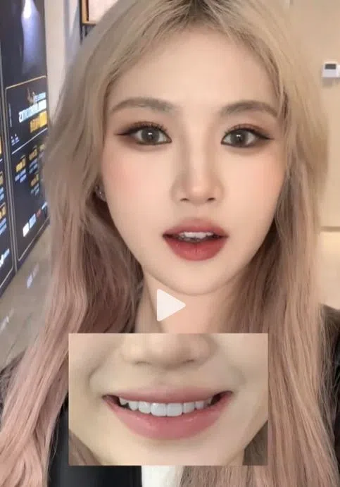 美妆博主尝试幼态牙贴片，对比前后效果。（抖音视频截图）