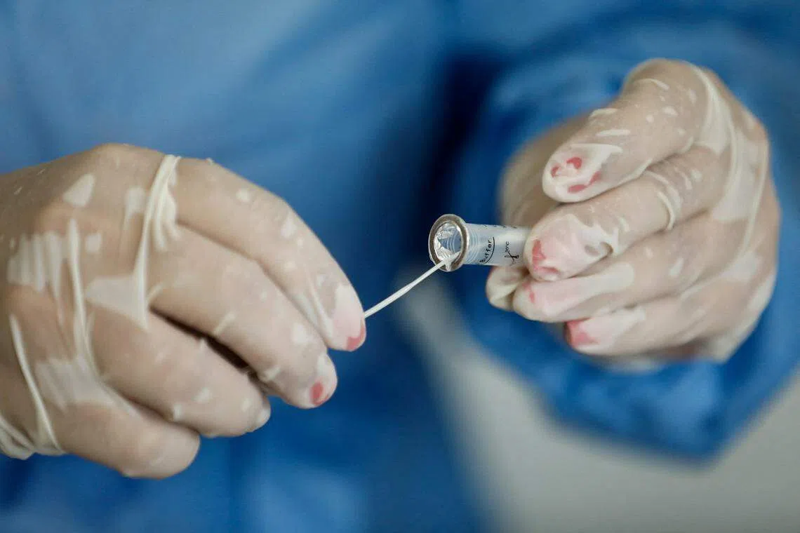 在巴西阿雷格里港发现冠病变体奥密克戎所致的病例后，一名卫生工作者在处理检测样本。照片摄于2022年1月20日。（路透社）