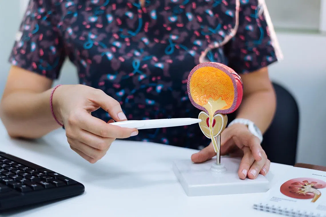 前列腺只有男性才有。笔尖指的部分是前列腺，中间为尿道，上方为膀胱。（档案照片）