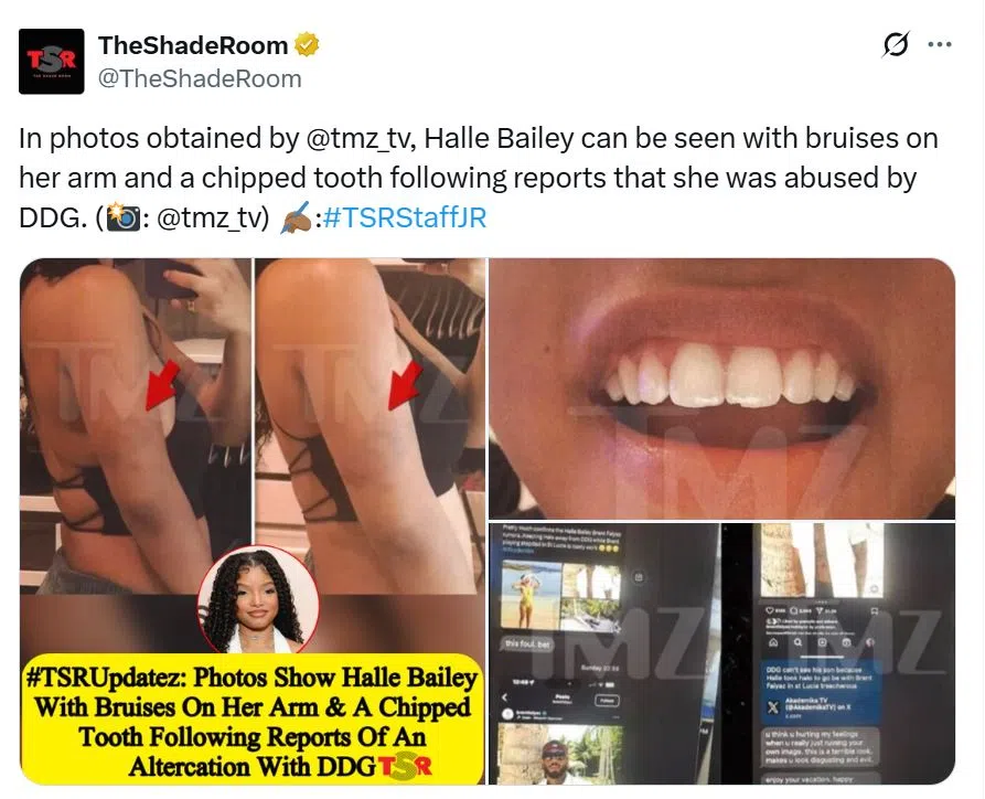 美媒爆出Bailey疑似遭家暴后的受伤照。（互联网）